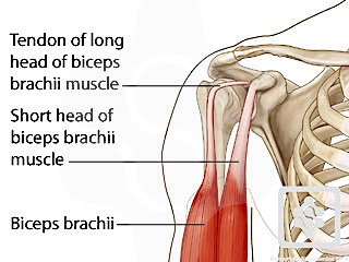 How do you diagnose torn bicep tendons?